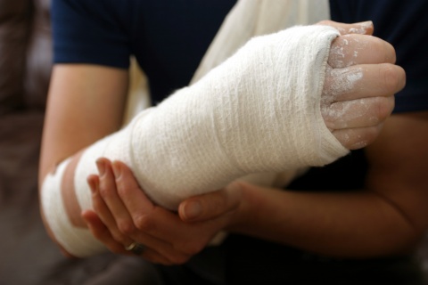 arm in a cast